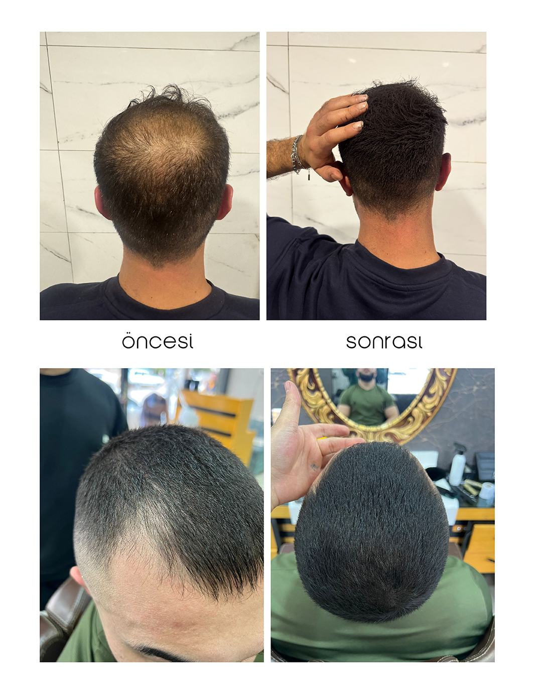 Slaj Saç Kapatıcı - görsel 3
