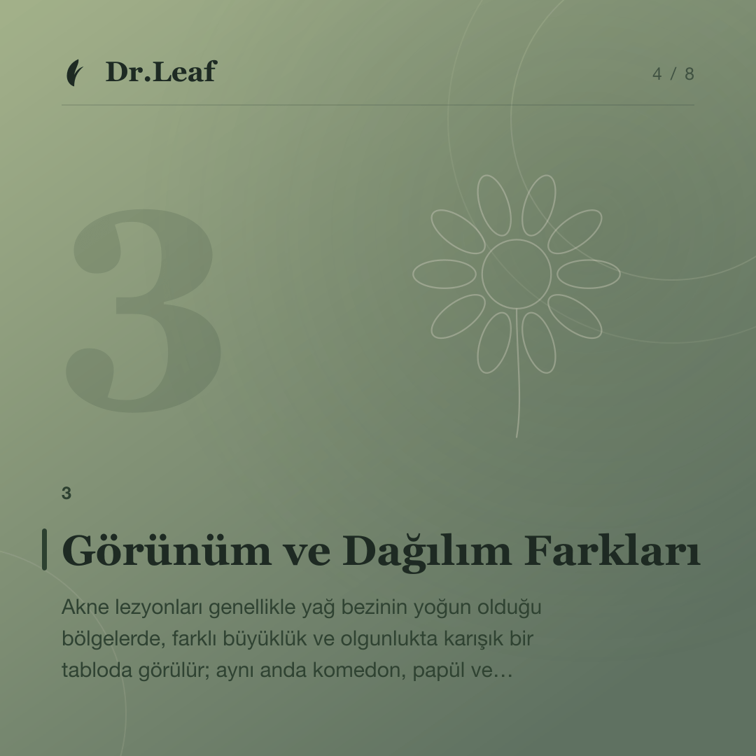 Akne ile Folikülit Arasındaki Fark Nedir?: Görünüm ve Dağılım Farkları — bilgi kartı 4