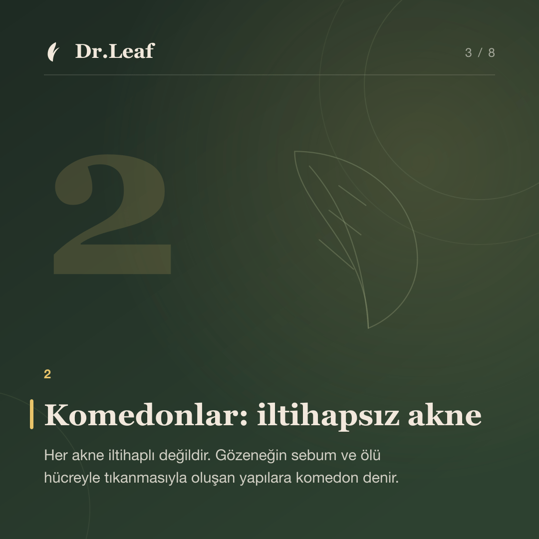 Akne Nedir? Türleri, Belirtileri ve Oluşum Nedenleri: Komedonlar: iltihapsız akne — bilgi kartı 3