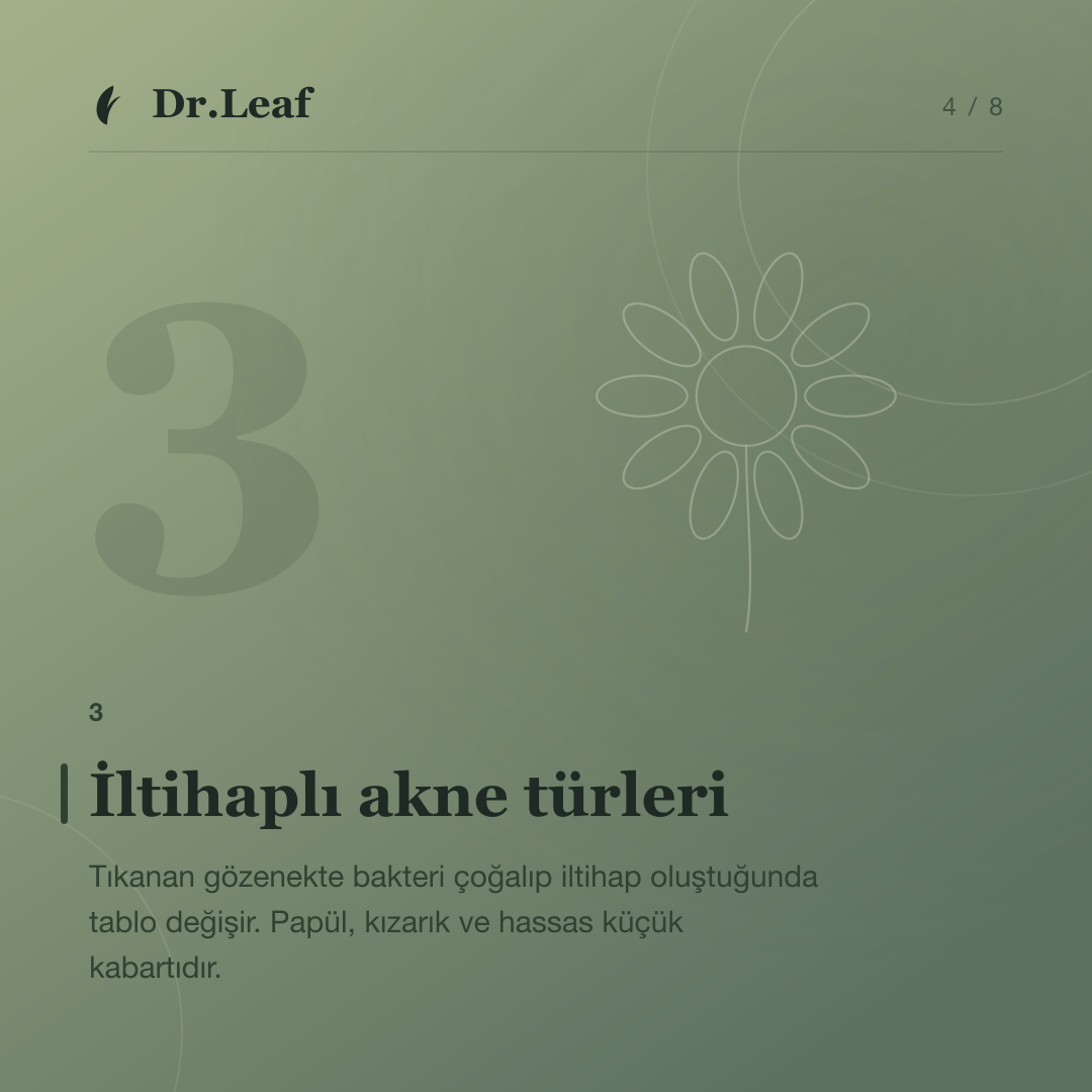 Akne Nedir? Türleri, Belirtileri ve Oluşum Nedenleri: İltihaplı akne türleri — bilgi kartı 4