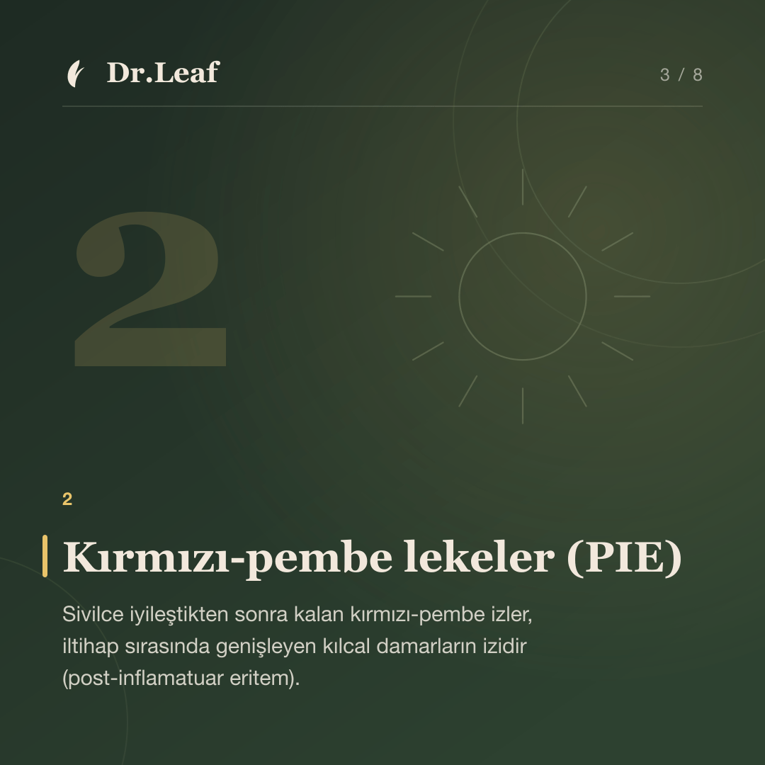 Akne Sonrası Kırmızı ve Kahverengi İzler Neden Kalır?: Kırmızı-pembe lekeler (PIE) — bilgi kartı 3