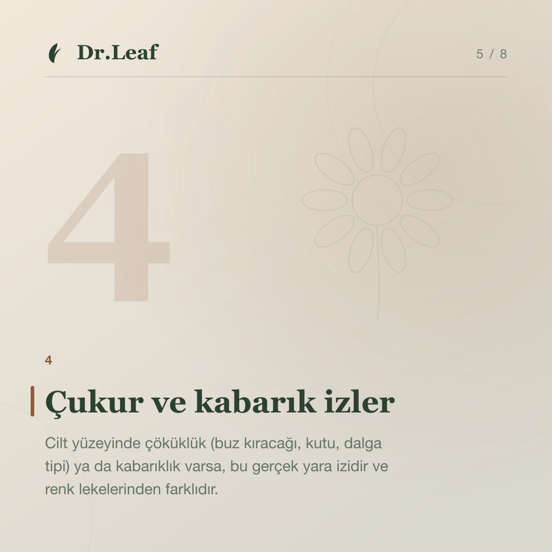 Akne Sonrası Kırmızı ve Kahverengi İzler Neden Kalır?: Çukur ve kabarık izler — bilgi kartı 5