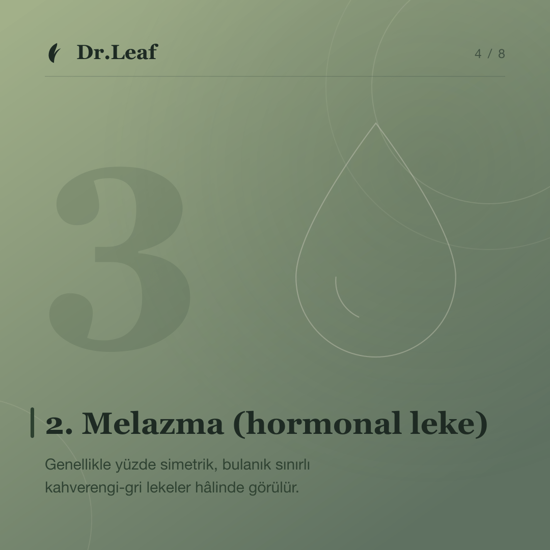 Cilt Lekeleri Neden Oluşur? Leke Türleri ve Korunma Yolları: 2. Melazma (hormonal leke) — bilgi kartı 4