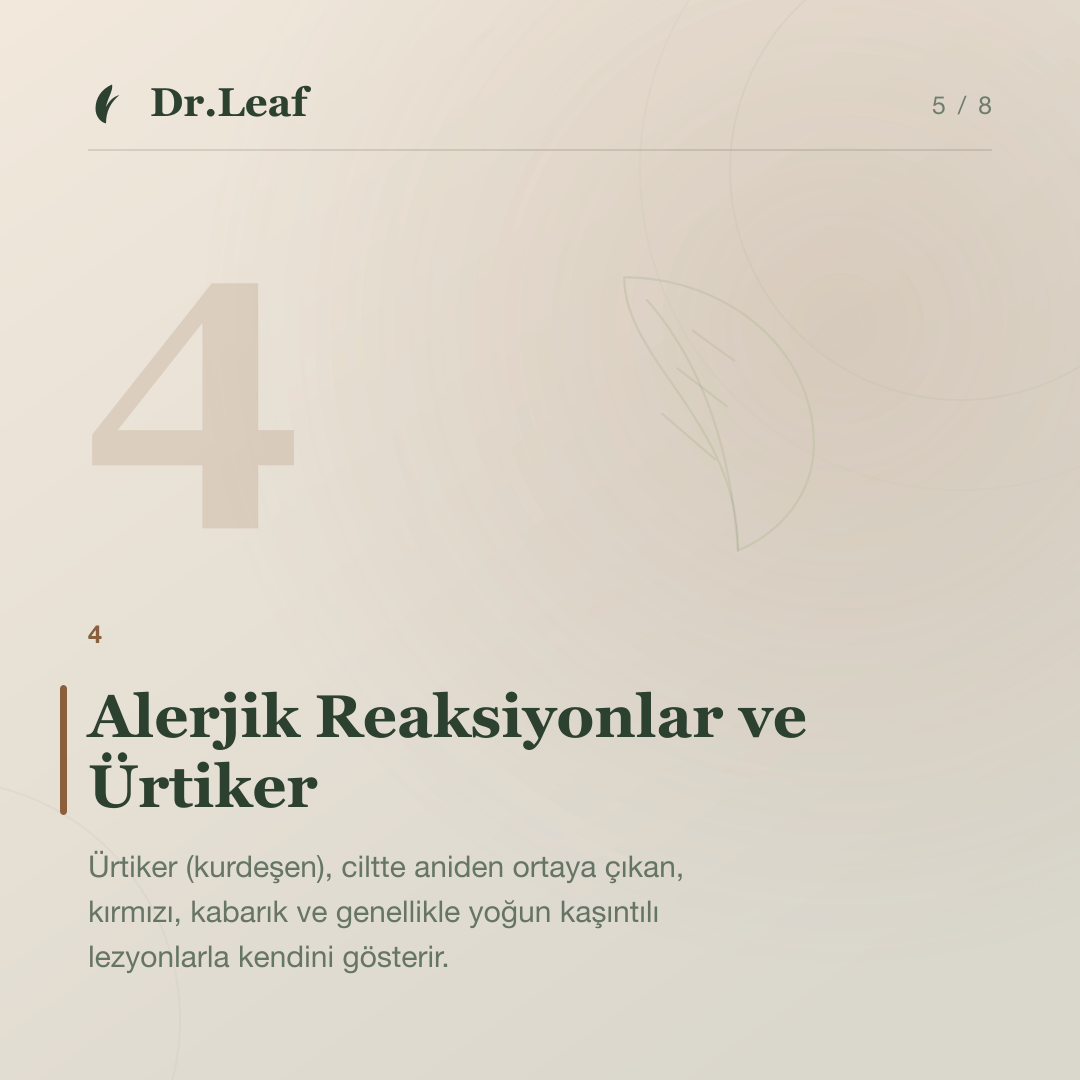 Ciltte Kaşıntı ve Döküntü Neden Oluşur?: Alerjik Reaksiyonlar ve Ürtiker — bilgi kartı 5