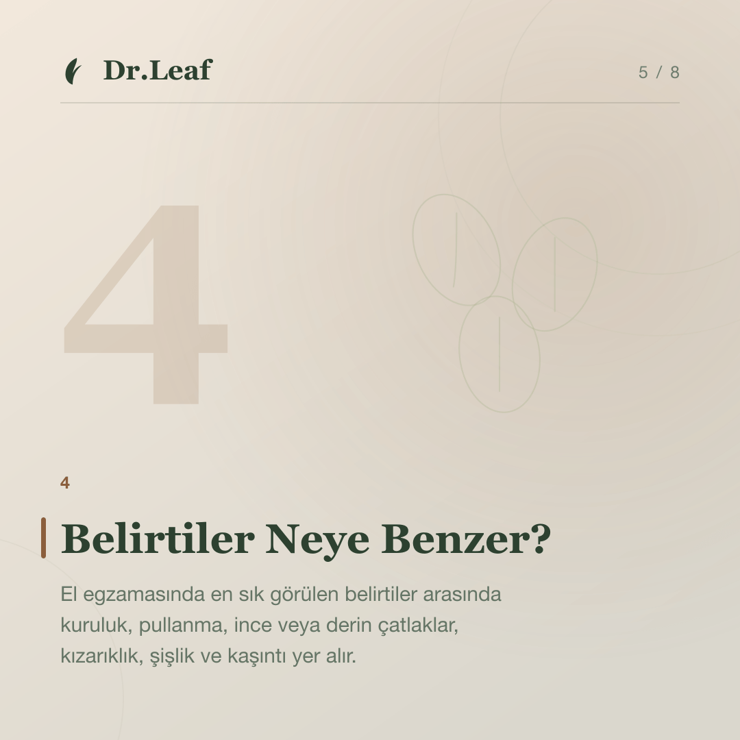 El Egzaması Nedir ve Neden Tekrarlar?: Belirtiler Neye Benzer? — bilgi kartı 5