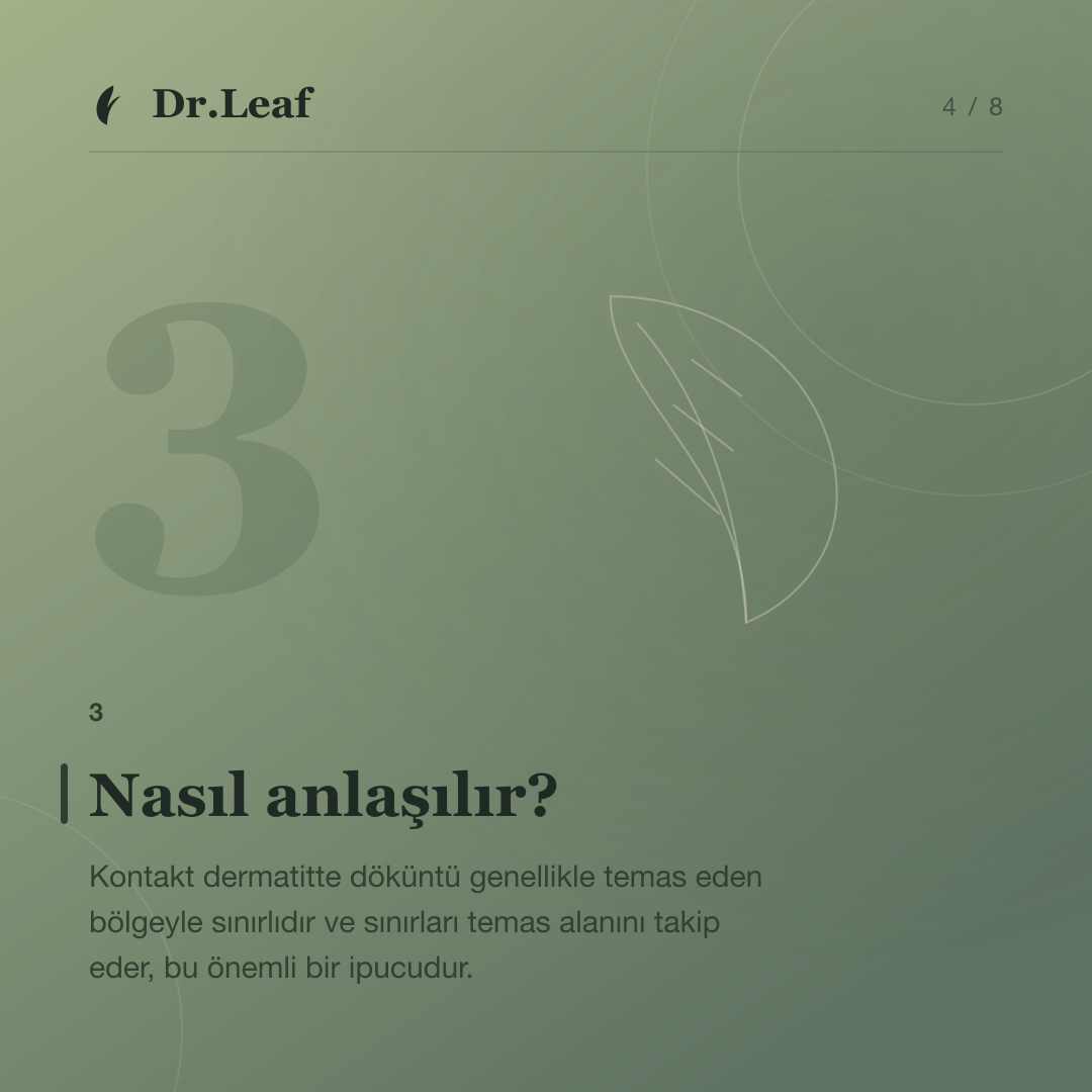 Kontakt Dermatit Nedir ve Neden Oluşur?: Nasıl anlaşılır? — bilgi kartı 4