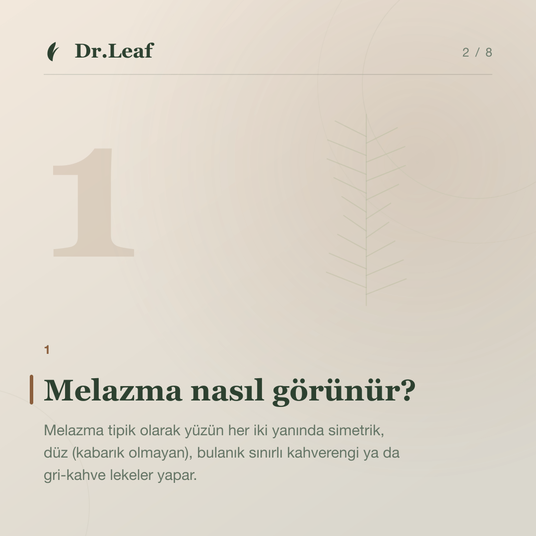 Melazma Nedir? Belirtileri ve Tetikleyicileri: Melazma nasıl görünür? — bilgi kartı 2