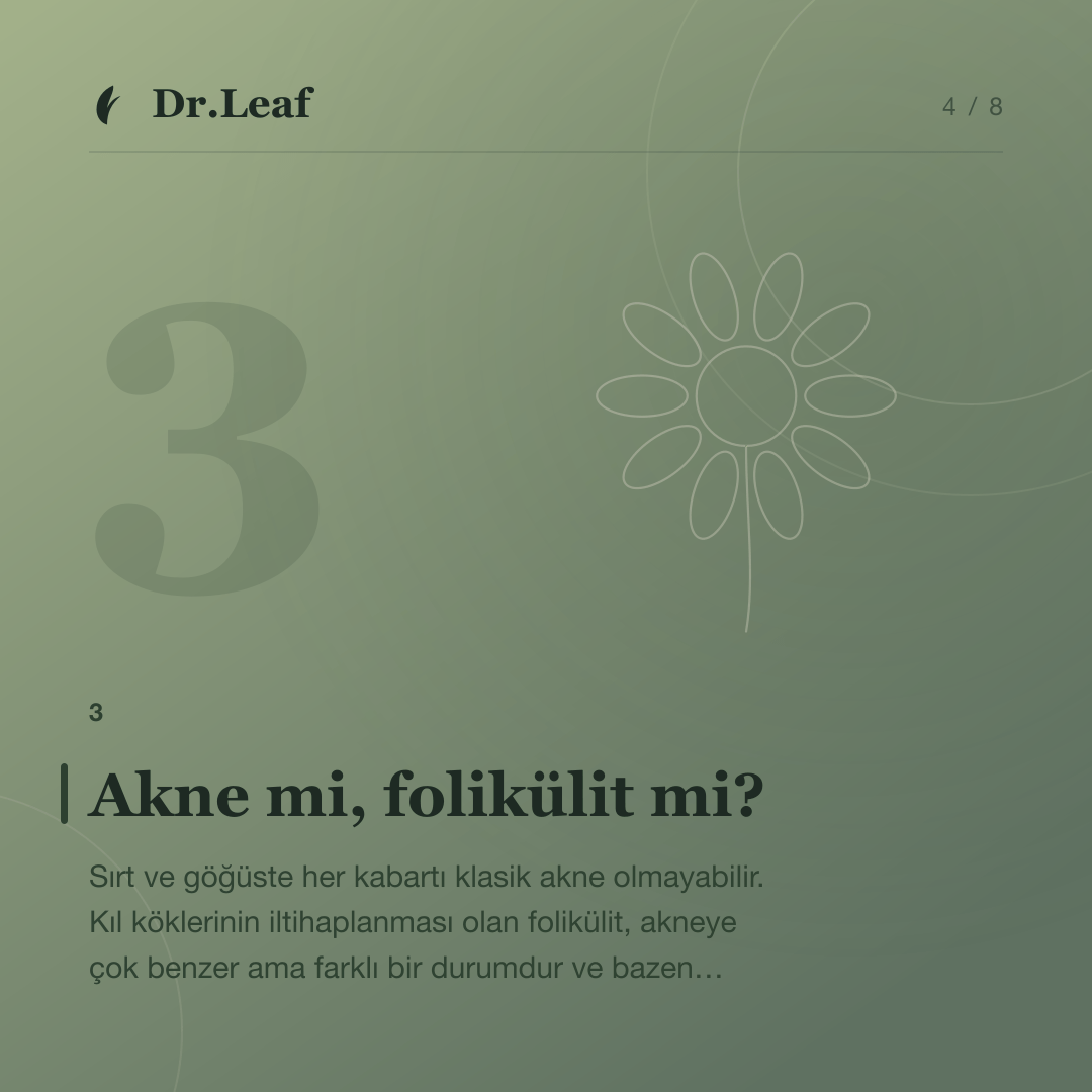 Sırt ve Göğüs Sivilceleri Neden Çıkar?: Akne mi, folikülit mi? — bilgi kartı 4
