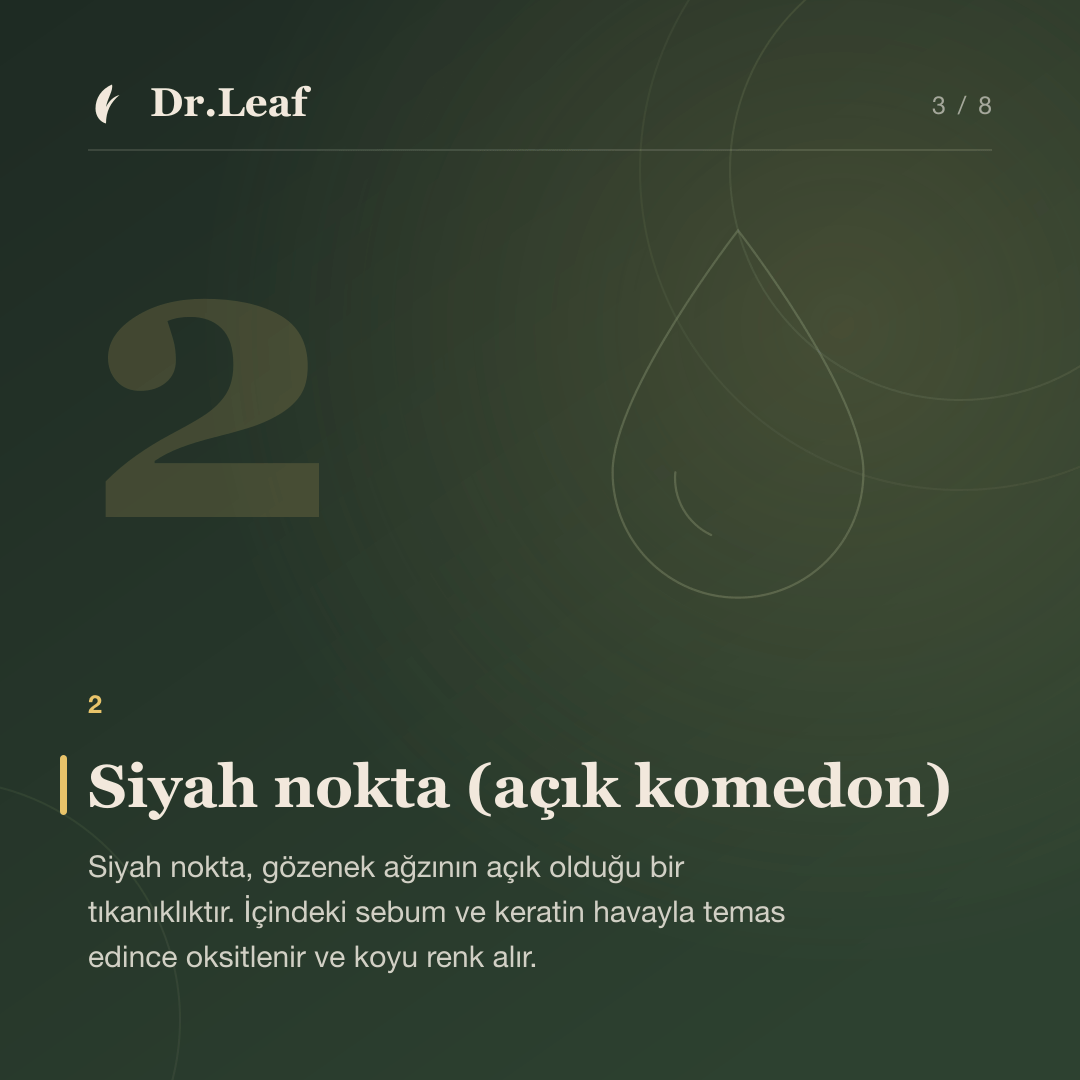 Siyah Nokta, Beyaz Nokta ve Kapalı Komedon Nedir?: Siyah nokta (açık komedon) — bilgi kartı 3