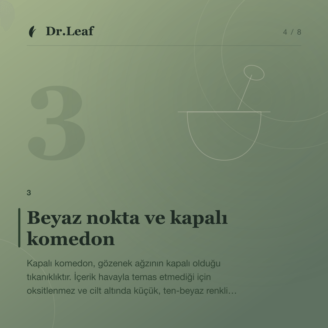 Siyah Nokta, Beyaz Nokta ve Kapalı Komedon Nedir?: Beyaz nokta ve kapalı komedon — bilgi kartı 4