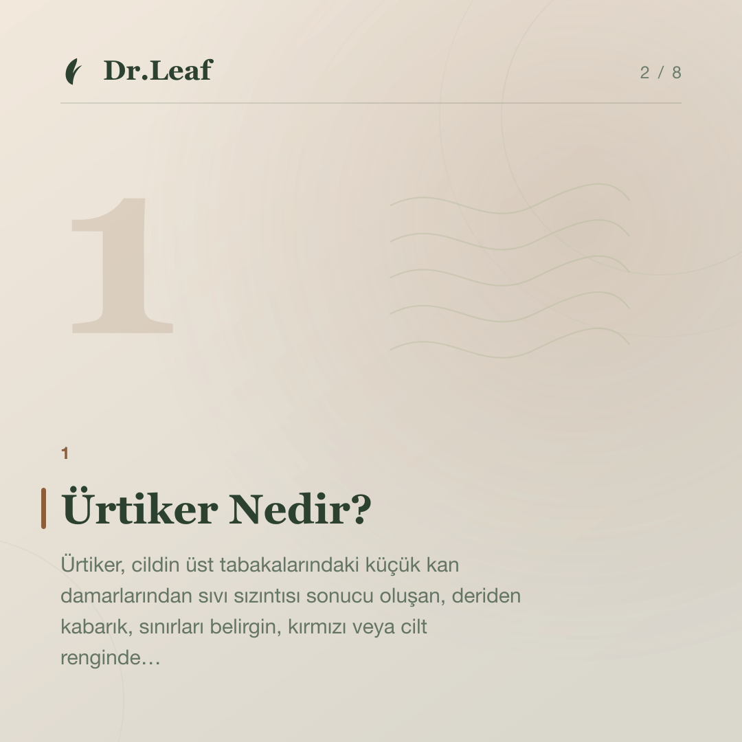 Ürtiker Nedir? Kurdeşen Belirtileri Nelerdir?: Ürtiker Nedir? — bilgi kartı 2