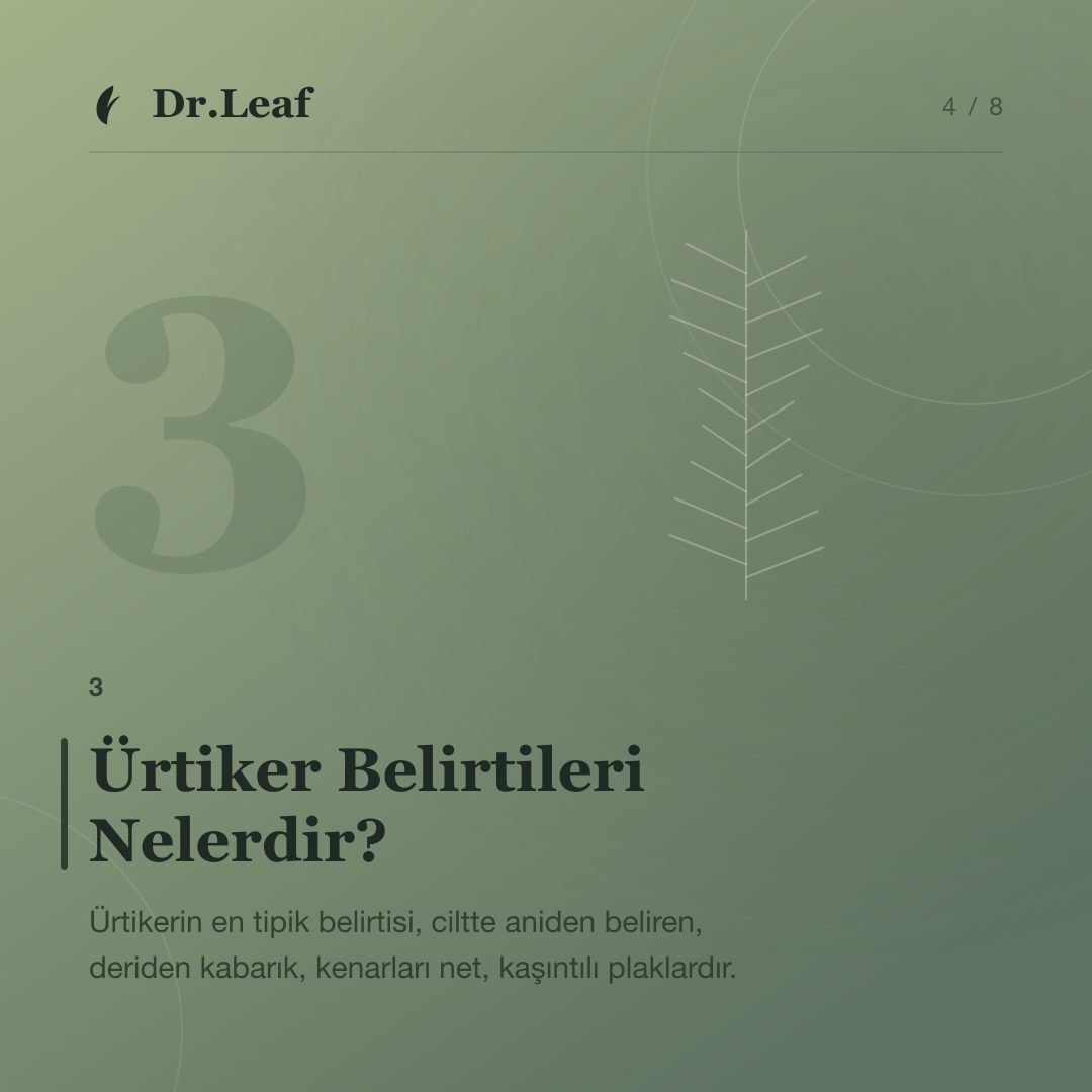 Ürtiker Nedir? Kurdeşen Belirtileri Nelerdir?: Ürtiker Belirtileri Nelerdir? — bilgi kartı 4