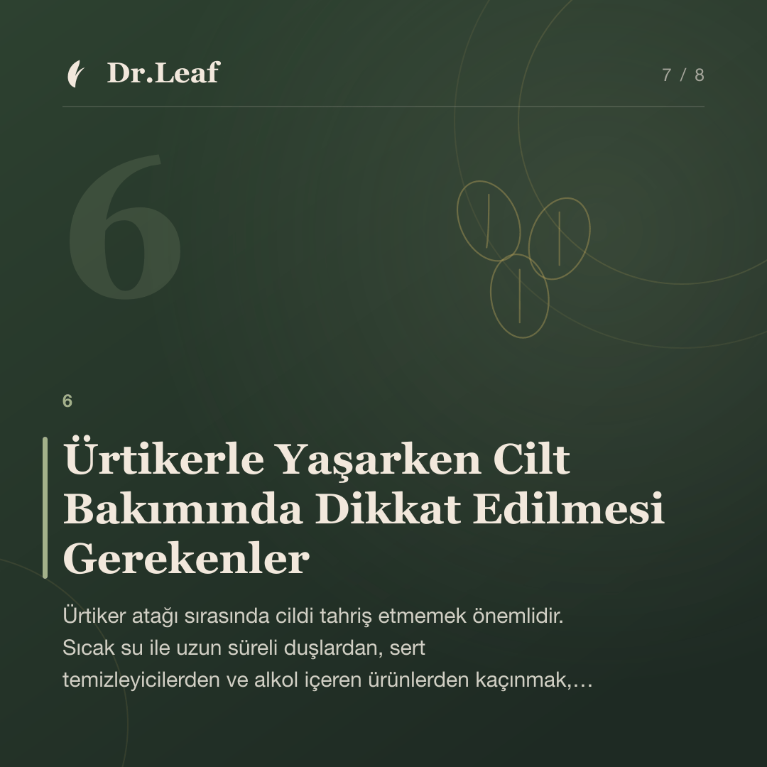 Ürtiker Nedir? Kurdeşen Belirtileri Nelerdir?: Ürtikerle Yaşarken Cilt Bakımında Dikkat Edilmesi Gerekenler — bilgi kartı 7